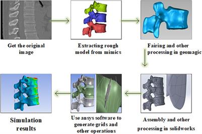 Finite element analysis of biomechanical effects of mineralized collagen modified bone cement on adjacent vertebral body after vertebroplasty